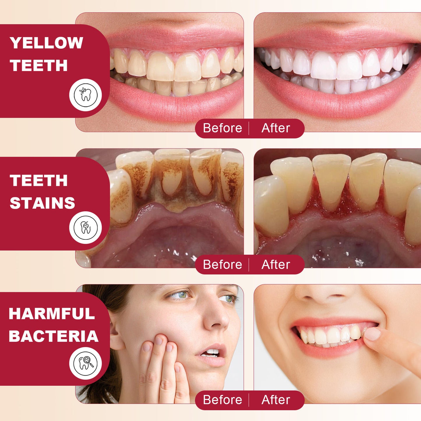 SP 4 Probiotic Whitening Toothpaste - Bright & Healthy Smile